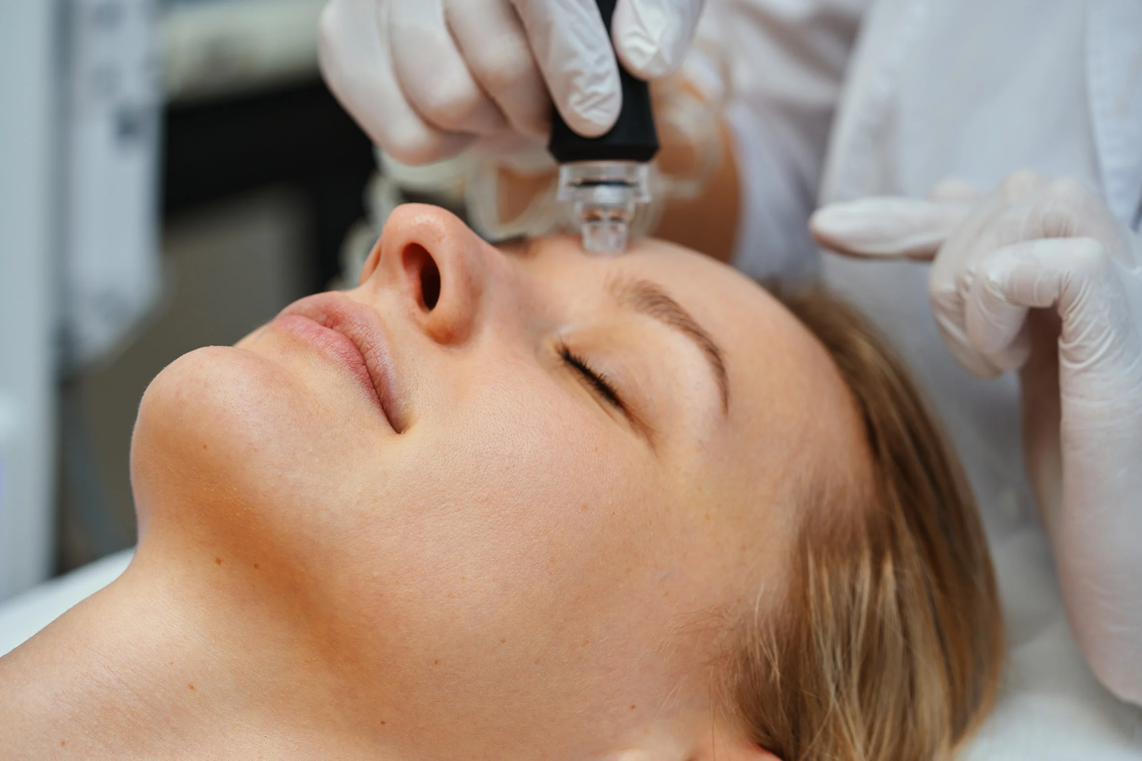 Female patient receiving eyelid rejuvenation treatment to improve the appearance of the area around her eyelids.