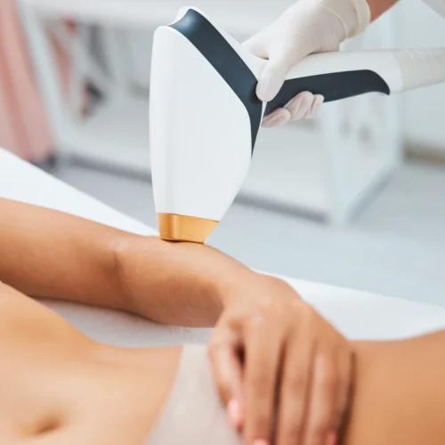 Female patient receiving laser hair removal treatment on her forearm.