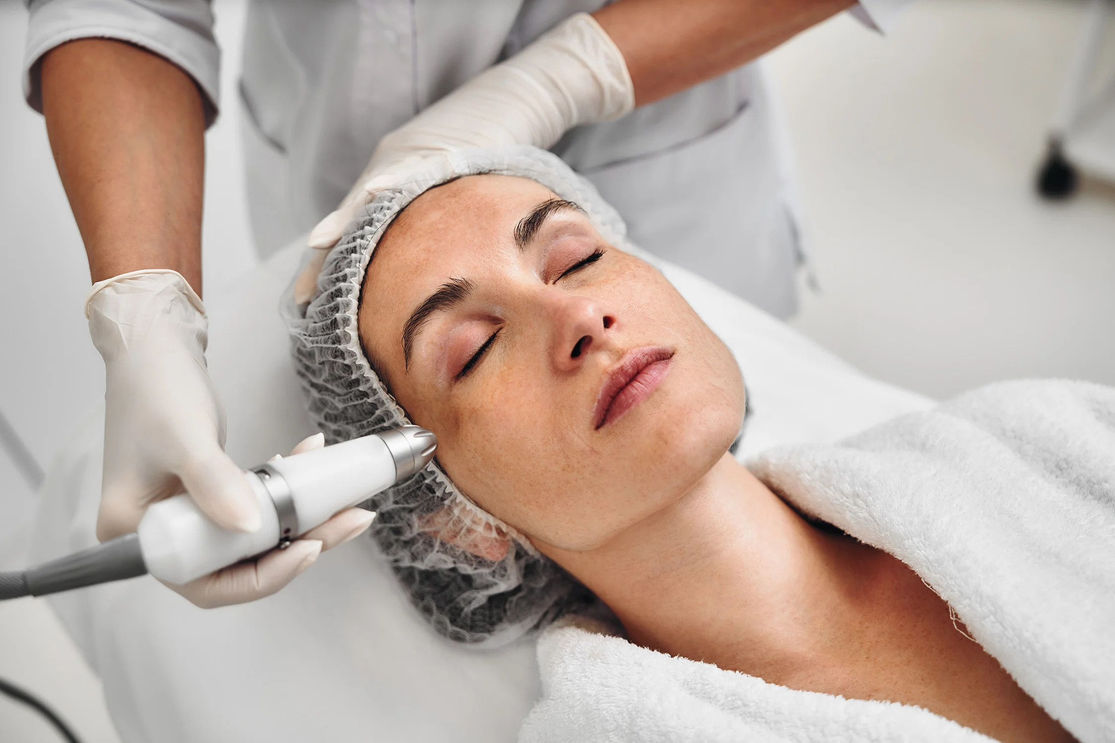 Female patient receiving skin resurfacing treatment on her face for skin rejuvenation.